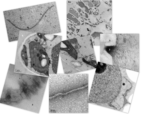 RSPaV virus, ultrastructure of grapevine leaf tissue, immunolocalization of virus and its protein in grapevine tissue.