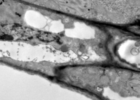  Cells with peroxisome (magnified on the previous picture) in potato leaf, TEM Philips CM100, Bioscan 792, Magda Tušek Žnidarič.