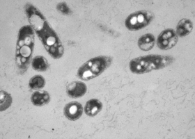  Ultrastructure of plant bacteria, TEM Philips CM100, Bioscan 792, Magda Tušek Žnidarič.