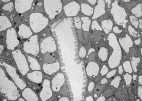  Tomato stem cells with sieve plates in phloem (magnified on the next picture), TEM Philips CM100, Bioscan 792, Magda Tušek Žnidarič.