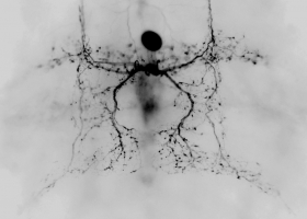  Insect vibratory interneuron (photo: M. Zorović)