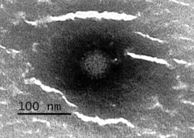  Electron micrographs of orthoreovirus strain. From Steyer et al. 2013. J. Clin. Microbiol. 