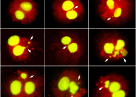  Images of HepG2 cells representing binucleated cell, micronucleus, nucleoplasmic bridge and nuclear bud. (photo: Dr. Bojana Žegura)