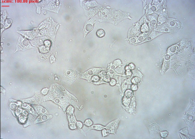  HepG2 cell line. (photo: Dr. Alja Štraser)