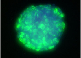 Glioblastoma stem cells derived spheroid, where a stem cell marker nestin is labeled with green fluorescence (100x magnification). (photo: Dr. Neža Podergajs)  Glioblastoma stem cells derived spheroid, where a stem cell marker nestin is labeled with green fluorescence (100x magnification). (photo: Dr. Neža Podergajs)