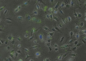 A549 cells labeled with aptamers (green fluorescence). (photo: Mateja Delač)  A549 cells labeled with aptamers (green fluorescence). (photo: Mateja Delač)