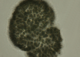 Potentially toxic cyanobacterium Woronichinia naegeliana often occurs in Slovenia. (photo: Dr. Tina Eleršek)  Potentially toxic cyanobacterium Woronichinia naegeliana often occurs in Slovenia. (photo: Dr. Tina Eleršek)