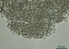 Cyanobacterium  Microcystis aeruginosa. (photo: Dr. Tina Eleršek)  Cyanobacterium  Microcystis aeruginosa. (photo: Dr. Tina Eleršek)